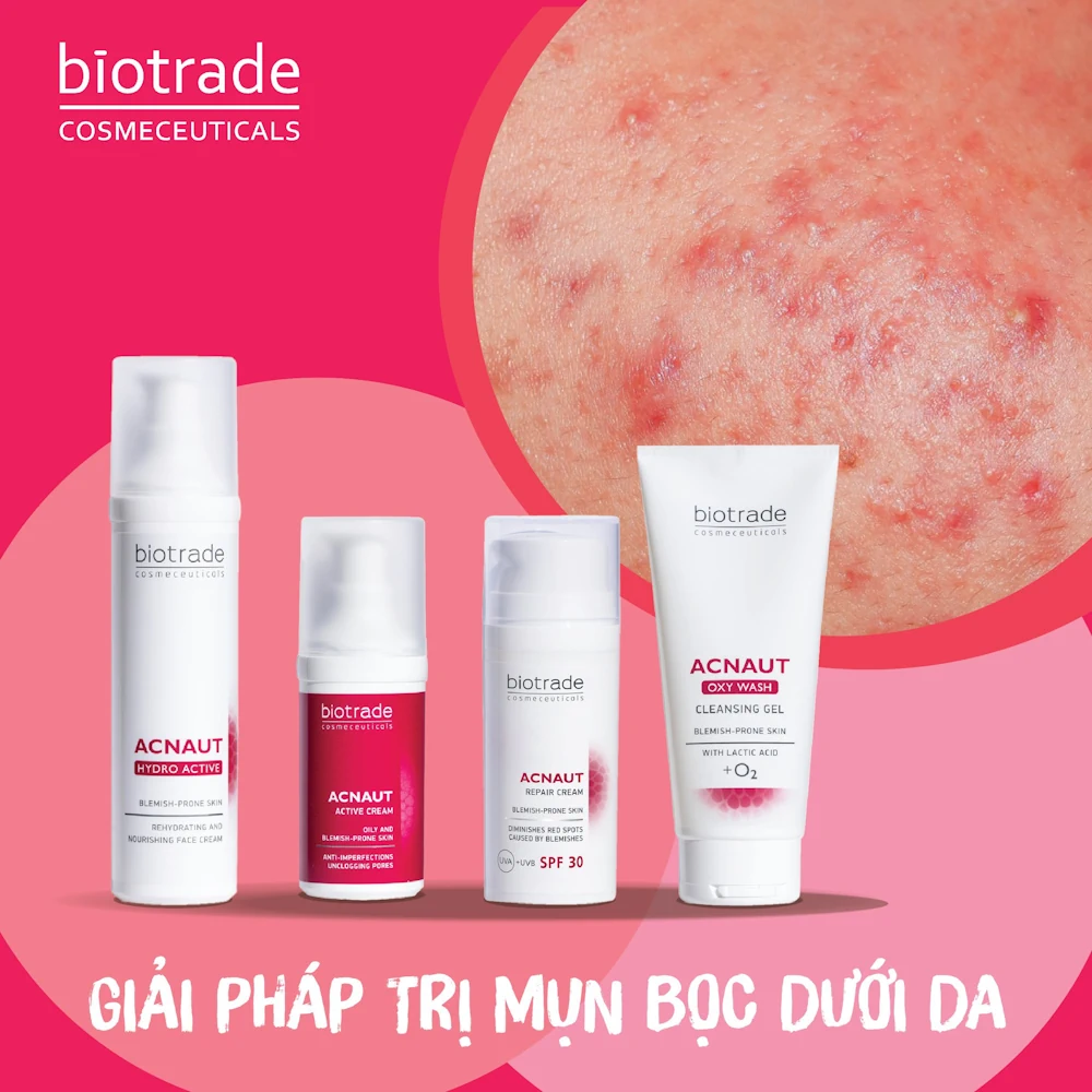 Combo Giảm Mụn Bọc Biotrade Acnaut - Giải Pháp Trị Mụn Bọc Dưới Da - 1Mall.vn