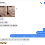 Review Dưỡng Mi Tế Bào Gốc C'choi - Bio-placenta Lash Serum - Punar - 1Mall.vn - Hình 10