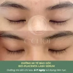 Review Dưỡng Mi Tế Bào Gốc C'choi - Bio-placenta Lash Serum - Punar - 1Mall.vn - Hình 13