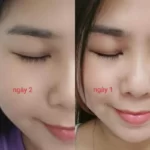 Review Dưỡng Mi Tế Bào Gốc C'choi - Bio-placenta Lash Serum - Punar - 1Mall.vn - Hình 8